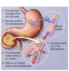 Diabetes Path